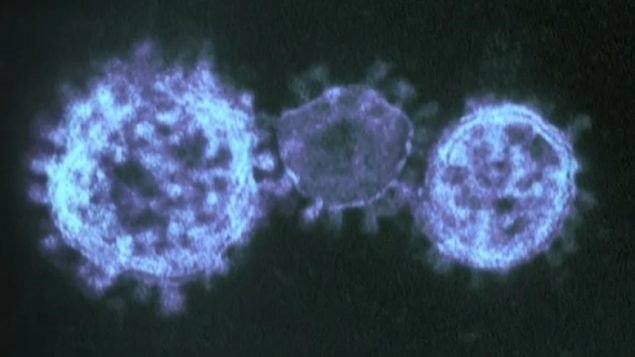 virus
